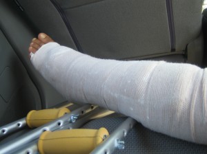1st Cast - pic 2