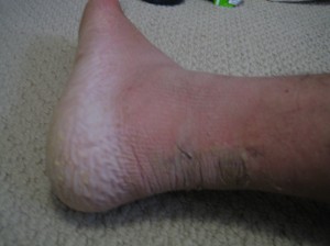 Nasty Foot 4