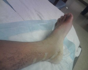 The first view of the crusty leg